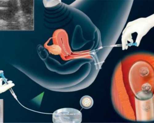 供卵试管群,贵港助孕骗子公司有哪家,广西三大助孕公司
