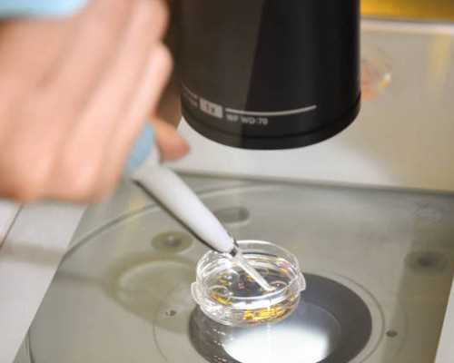 供卵试管哪家专业,兰州助孕公司官网_试管助孕机构