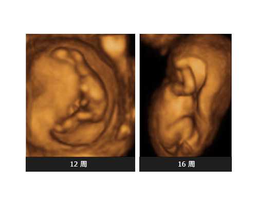 供卵试管代孕男孩过程,广州助孕公司有哪些_试管助孕机构