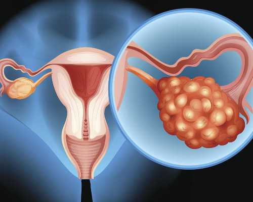 供卵试管做三代,广州助孕公司有哪些_试管助孕机构