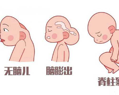 高龄高危产妇是多少岁