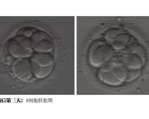 给宝宝添加辅食必知