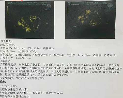 供卵助孕哪里便宜点,石家庄助孕qq群-正规助孕中介